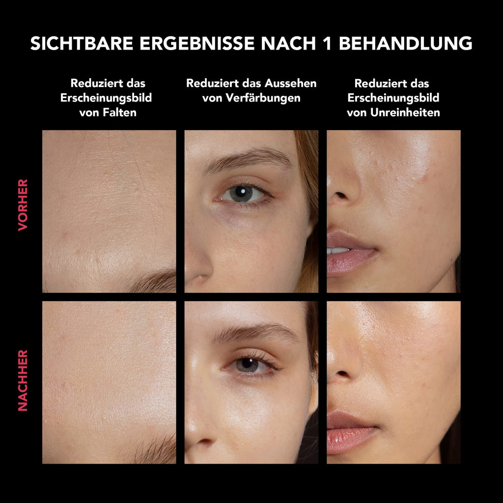 FAQ 202 LED-Gesichtsmaske + FAQ Glass Skin Kollagenmasken-Set, 5 Stk.